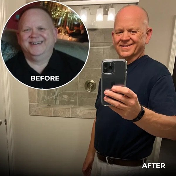 Stuart Davis transformation